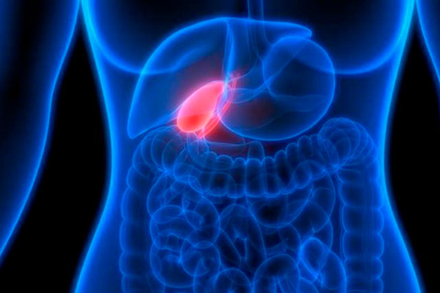 Dr Paulo Ramalho - Colecistite Aguda