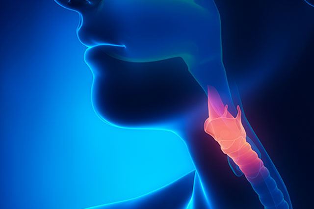 Dr Paulo Ramalho - Câncer de esôfago